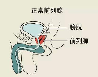 前列腺增生手术，前列腺增生手术费用，前列腺增生手术贵吗？